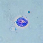 顕微鏡で見たトリコモナス（染色済）