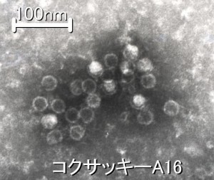 コクサッキーウイルス